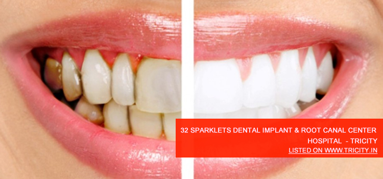 32 Sparklets Dental Implant & Root Canal Center Mohali
